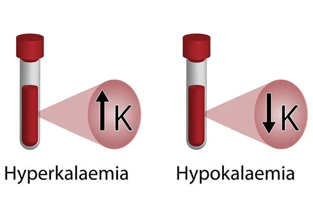 نقش عنصر پتاسیم در بدن